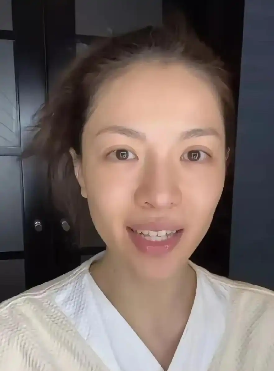 国内雀斑多的女明星_娱乐圈真实素颜_明星卸妆前后颜值对比