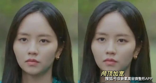 额头窄颧骨高的女明星_韩素希高颧骨审美_韩素希骨相美女